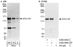 Detection of human STK11IP by western blot and immunoprecipitation.