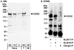 Detection of human GCN2 by western blot and immunoprecipitation.