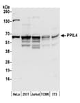 Detection of human and mouse PPIL4 by western blot.