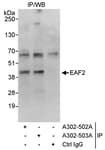 Detection of human EAF2 by western blot of immunoprecipitates.