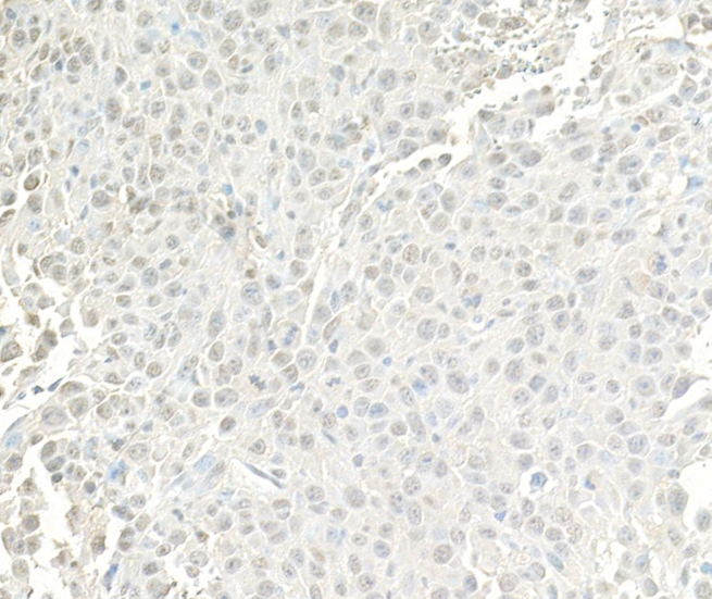 Detection of mouse BRG1/SMARCA4 by immunohistochemistry.