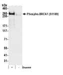 Detection of human Phospho-BRCA1 (S1189) by western blot.
