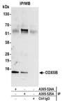 Detection of human COX5B by western blot of immunoprecipitates.