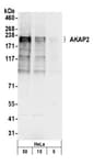 Detection of human AKAP2 by western blot.