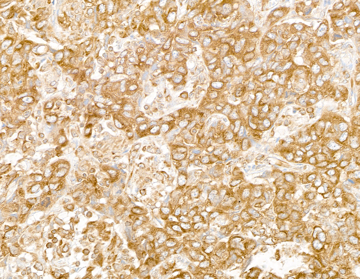 Detection of human RPL7 by immunohistochemistry.