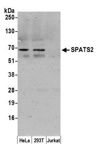 Detection of human SPATS2 by western blot.