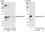 Detection of human ARHGEF16 by western blot and immunoprecipitation.