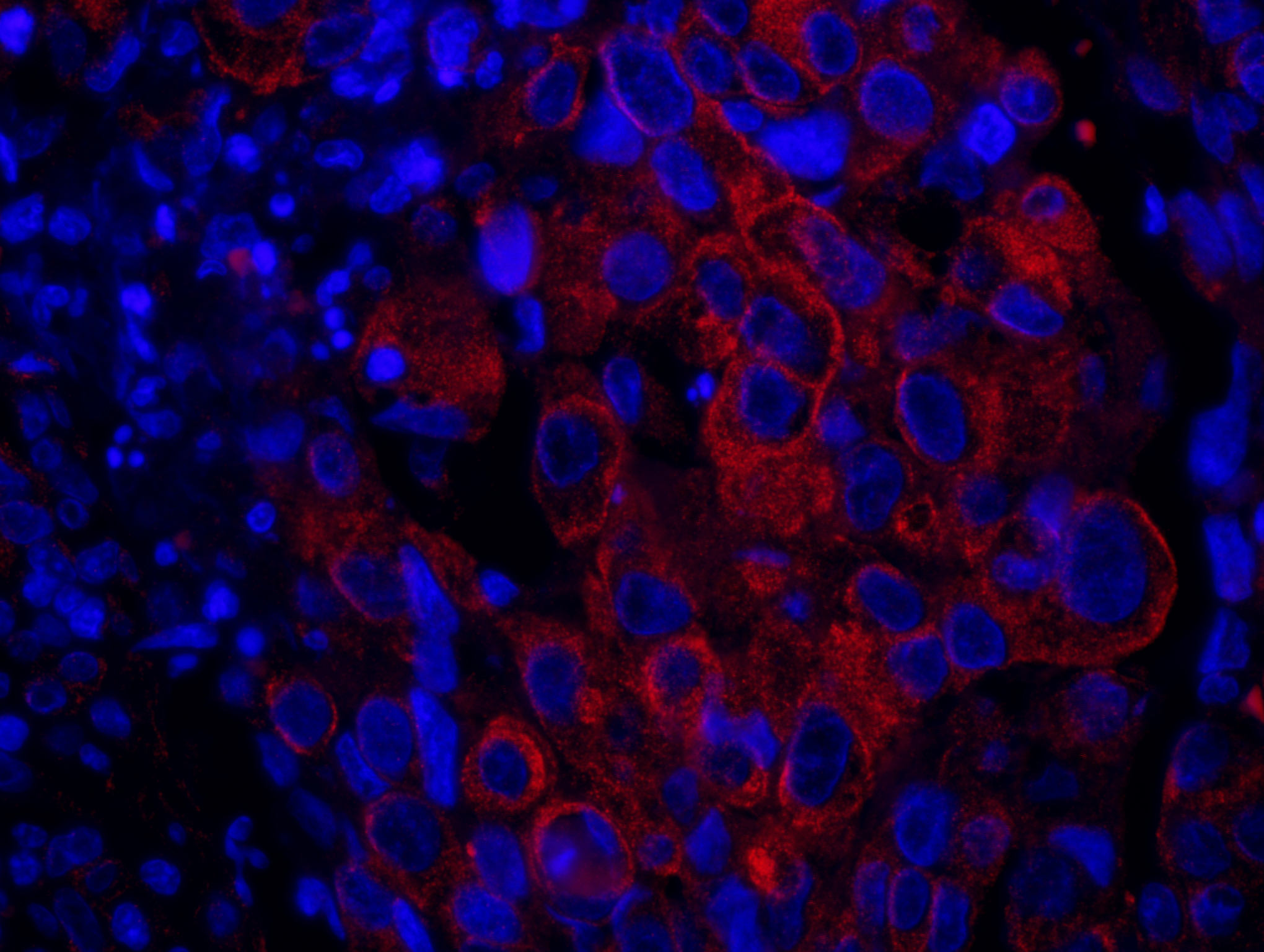 Rabbit anti-SASH1 IHC Antibody