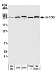 Detection of mouse ch-TOG by western blot.