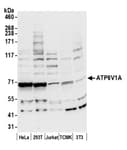 Detection of human and mouse ATP6V1A by western blot.