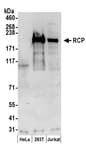 Detection of human RCP by western blot.