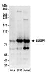 Detection of human SUGP1 by western blot.