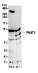 Detection of human PNUTS by western blot.