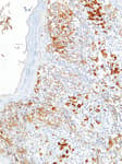 Detection of human KBA.62 by immunohistochemistry.