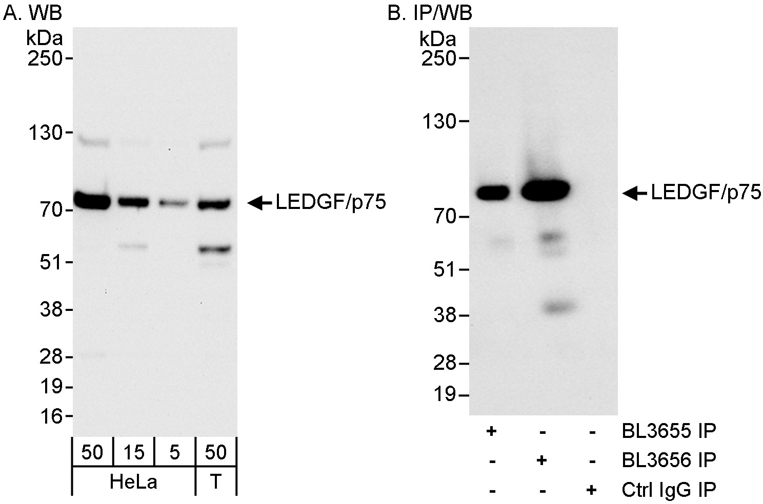 Detection of human LEDGF/p75 by western blot and immunoprecipitation.