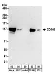 Detection of human and mouse CD146 by western blot.