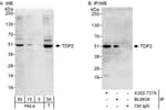Detection of human TDP2 by western blot and immunoprecipitation.