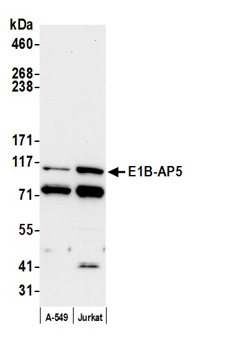 Rabbit anti-E1B-AP5 Antibody, Affinity Purified, image 1