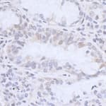 Detection of human HMGN3 by immunohistochemistry.
