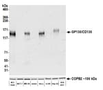 Detection of human GP130/CD130 by western blot.