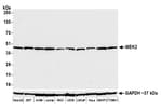 Detection of human and mouse MEK2 by western blot.