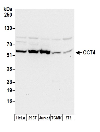 Detection of human and mouse CCT4 by western blot.