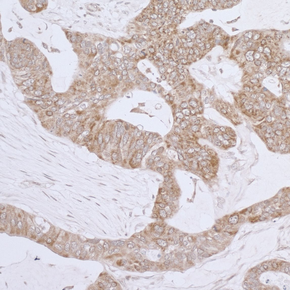 Detection of human LRPPRC by immunohistochemistry.