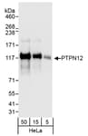 Detection of human PTPN12 by western blot.