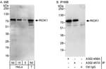 Detection of human RIOK1 by western blot and immunoprecipitation.