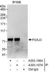 Detection of human FOXJ3 by western blot of immunoprecipitates.