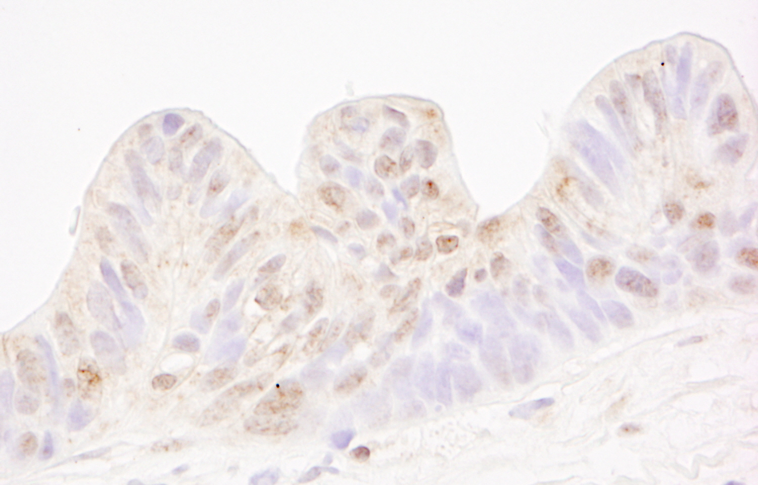 Rabbit anti-MBD4 IHC Antibody