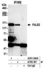 Detection of human PALB2 by western blot of immunoprecipitates.