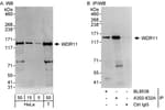 Detection of human WDR11 by western blot and immunoprecipitation.