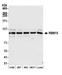 Detection of human RBM15 by western blot.