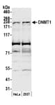 Detection of human DNMT1 by western blot.