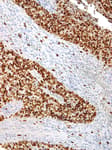 Detection of human Ki-67 by immunohistochemistry.