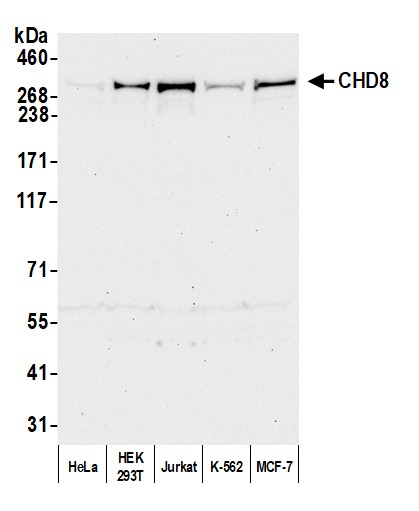 Detection of human CHD8 by western blot.