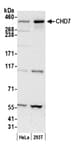 Detection of human CHD7 by western blot.
