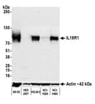 Detection of human IL18R1 by western blot.