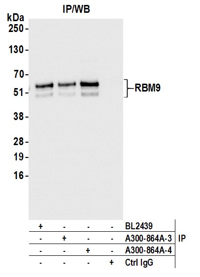 Detection of human FOX2/RBM9 by immunohistochemistry.