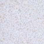 Detection of mouse CDC20 by immunohistochemistry.