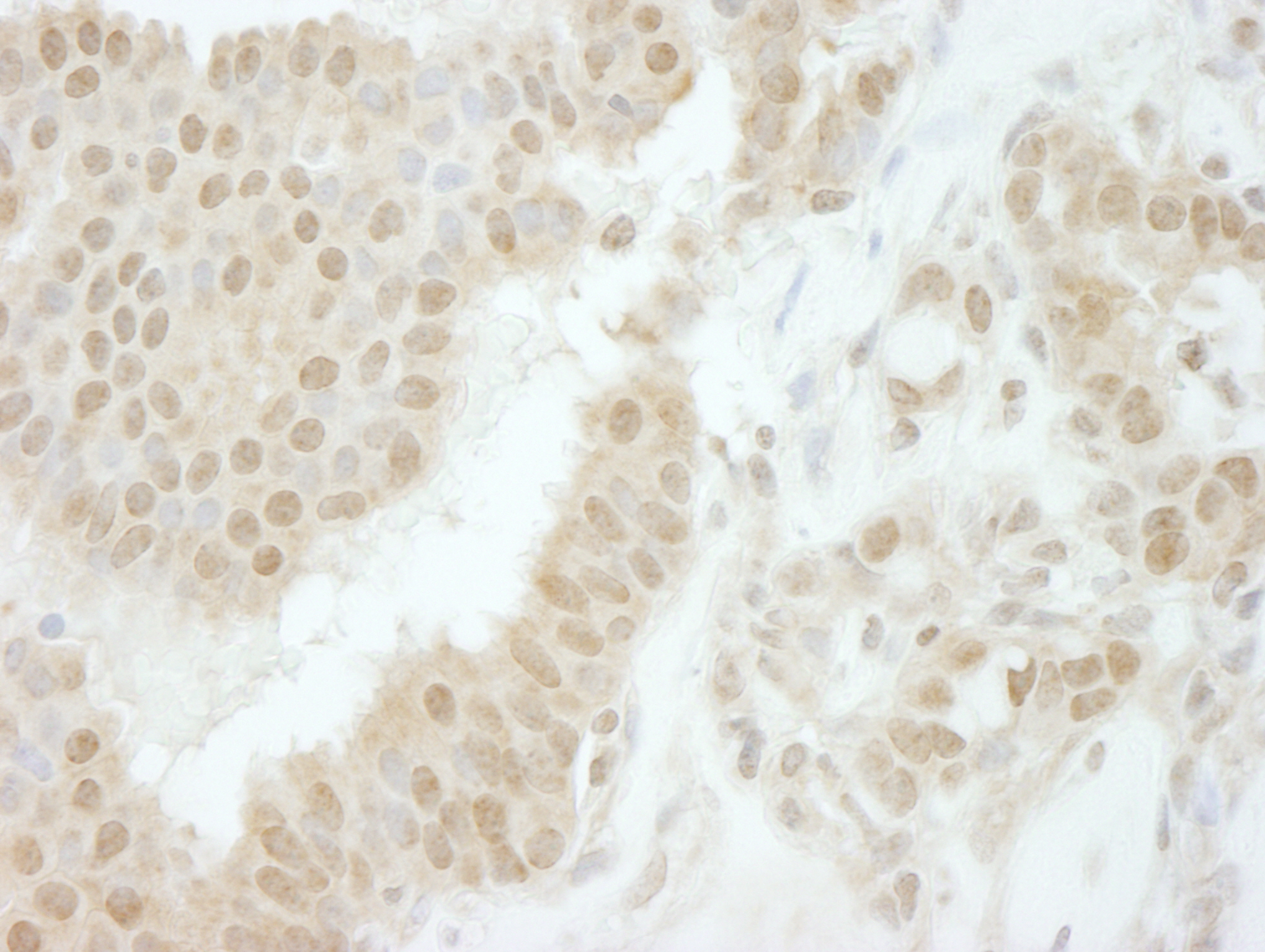Rabbit anti-Tip41 IHC Antibody