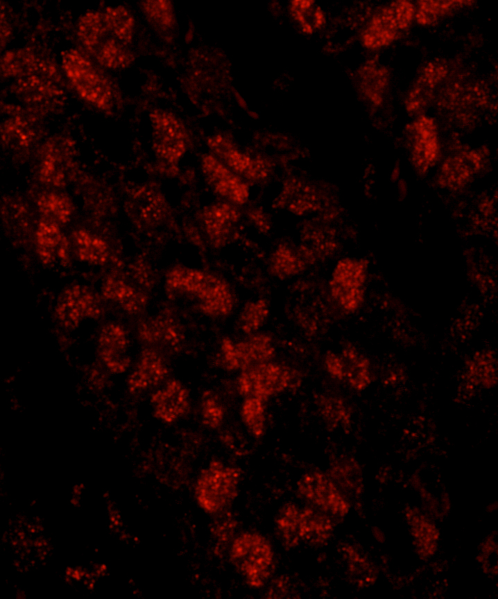 Rabbit anti-CTF18 IHC Antibody