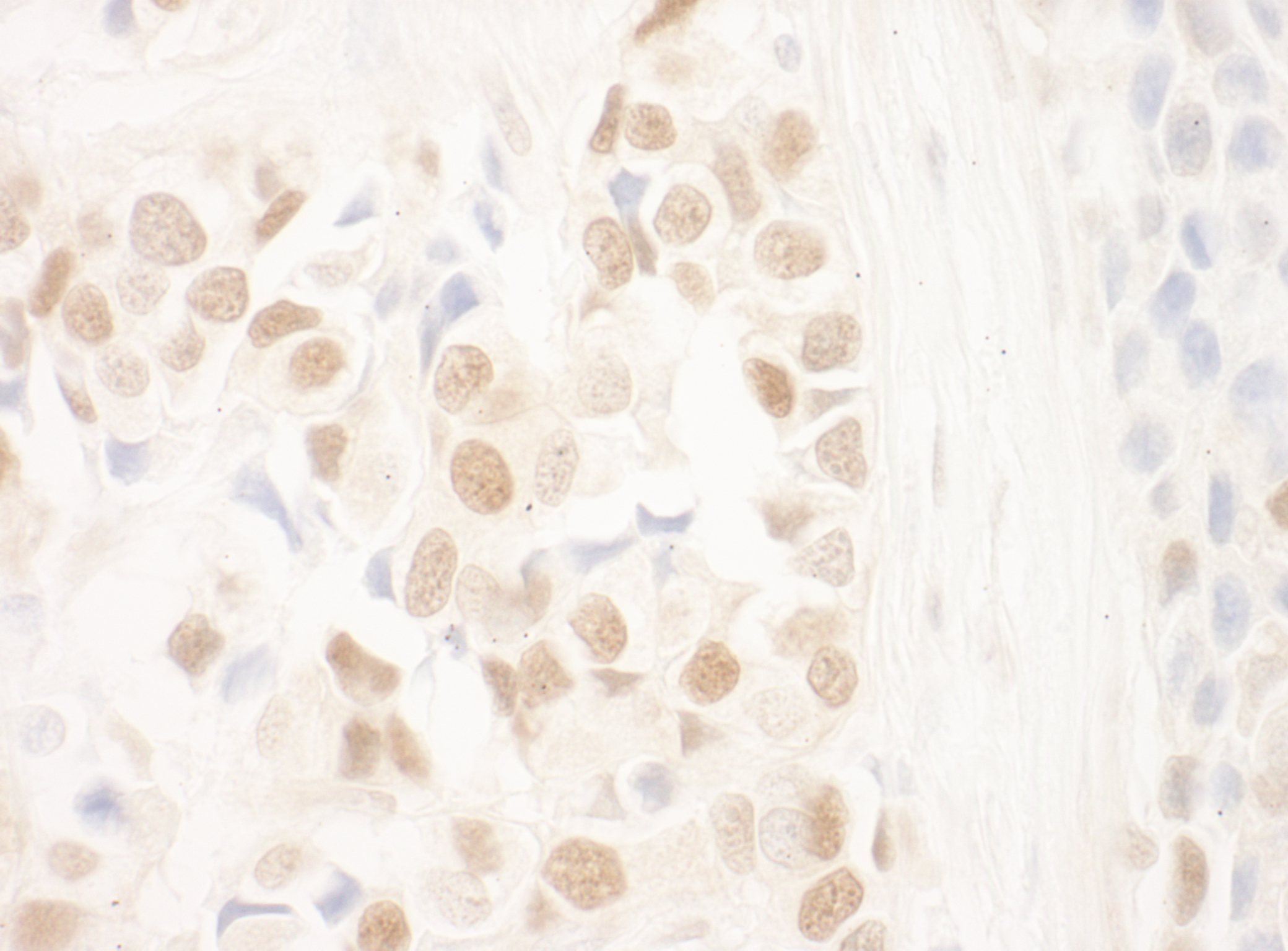 Rabbit anti-NRIP IHC Antibody