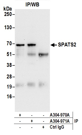 Detection of human SPATS2 by western blot of immunoprecipitates.