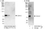Detection of human COX-2 by western blot and immunoprecipitation.