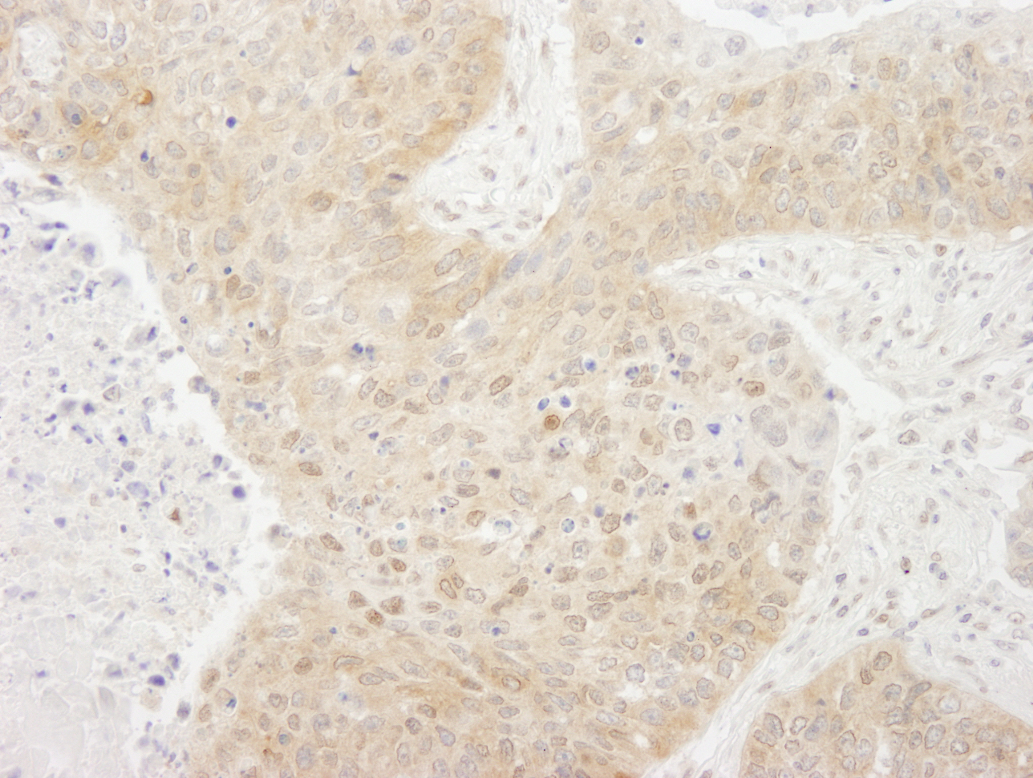 Rabbit anti-TORC1 IHC Antibody