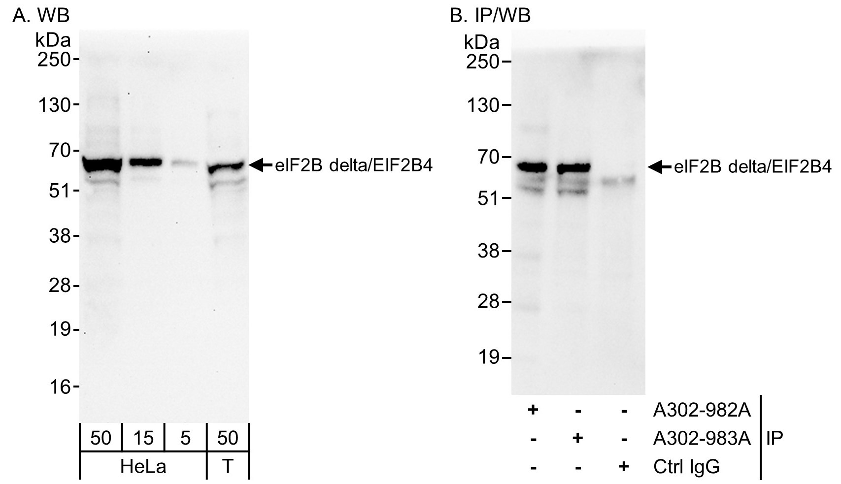 Detection of human eIF2B delta/EIF2B4 by western blot and immunoprecipitation.