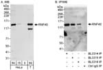 Detection of human RNF40 by western blot and immunoprecipitation.