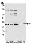 Detection of human and mouse NIT2 by western blot.